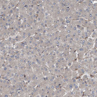 Immunohistochemical staining of human Liver shows very weak granular cytoplasmic positivity in in hepatocytes.