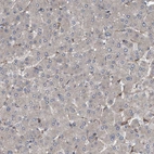 Immunohistochemical staining of human Liver shows very weak granular cytoplasmic positivity in in hepatocytes.