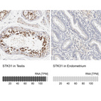 Anti-STK31 Antibody