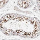 Immunohistochemical staining of human testis shows high expression.