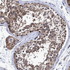 Immunohistochemical staining of human testis shows strong cytoplasmic positivity in cells in seminiferous ducts.