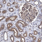 Immunohistochemical staining of human kidney shows moderate cytoplasmic positivity in cells in tubules.