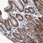 Immunohistochemical staining of human stomach shows strong cytoplasmic positivity in glandular cells.