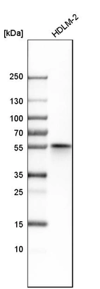 Western blot analysis in human cell line HDLM-2.