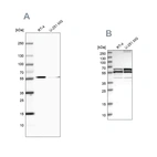 Western blot analysis using Anti-CALCOCO2 antibody HPA023195 (A) shows similar pattern to independent antibody HPA022989 (B).