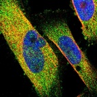 Immunofluorescent staining of human cell line U-251 MG shows localization to cytosol.