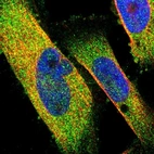 Immunofluorescent staining of human cell line U-251 MG shows localization to cytosol.