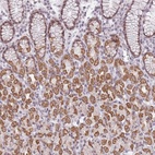Anti-ZNF574 Antibody
