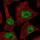 Immunofluorescent staining of human cell line A549 shows localization to nucleoplasm.