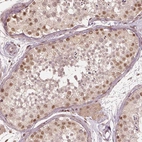 Immunohistochemical staining of human Testis shows moderate nuclear positivity in cells in seminiferous ducts.
