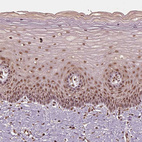 Immunohistochemical staining of human Cervix shows moderate nuclear positivity in squamous epithelial cells.