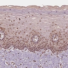 Immunohistochemical staining of human Cervix shows moderate nuclear positivity in squamous epithelial cells.