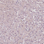 Immunohistochemical staining of human Liver shows very weak nuclear positivity in hepatocytes.