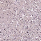 Immunohistochemical staining of human Liver shows very weak nuclear positivity in hepatocytes.