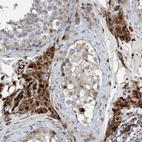 Anti-POLG2 Antibody