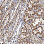 Immunohistochemical staining of human kidney shows moderate granular cytoplasmic positivity in cells in tubules.