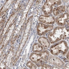 Immunohistochemical staining of human kidney shows moderate granular cytoplasmic positivity in cells in tubules.