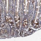 Immunohistochemical staining of human duodenum shows cytoplasmic positivity in glandular cells.