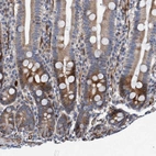 Immunohistochemical staining of human duodenum shows cytoplasmic positivity in glandular cells.