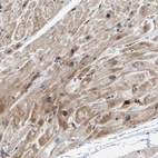 Immunohistochemical staining of human heart muscle shows cytoplasmic positivity.