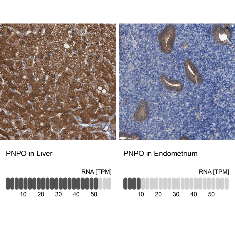 Anti-PNPO Antibody