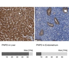 Anti-PNPO Antibody