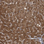 Immunohistochemical staining of human liver shows strong cytoplasmic positivity in hepatocytes.
