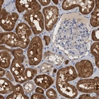 Immunohistochemical staining of human kidney shows strong cytoplasmic positivity in cells in tubules.