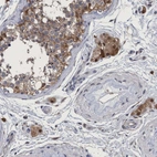 Immunohistochemical staining of human testis shows moderate cytoplasmic-nuclear positivity in Leydig cells and moderate cytoplasmic positivity in cells in seminiferous ducts.
