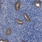 Immunohistochemical staining of human endometrium shows moderate cytoplasmic positivity in glandular cells.
