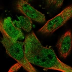 Immunofluorescent staining of human cell line U-251 MG shows localization to nucleoplasm & cytosol.