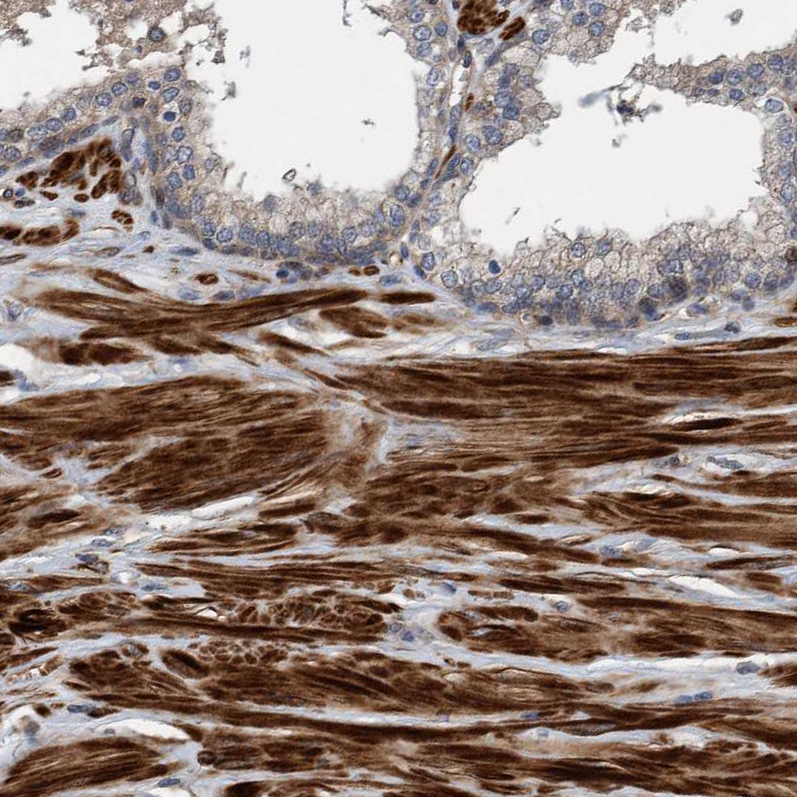 Anti-GRPEL2 Antibody