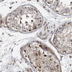 Immunohistochemical staining of human testis shows strong cytoplasmic positivity in a subset of cells in seminiferous ducts.