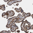 Immunohistochemical staining of human placenta shows moderate cytoplasmic positivity in trophoblastic cells.