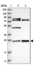 Lane 1: Marker [kDa] 230, 130, 95, 72, 56, 36, 28, 17, 11_br/_Lane 2: Human cell line RT-4_br/_Lane 3: Human cell line U-251MG sp