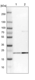 Lane 1: NIH-3T3 cell lysate (Mouse embryonic fibroblast cells)_br/_Lane 2: NBT-II cell lysate (Rat Wistar bladder tumour cells)