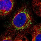 Immunofluorescent staining of human cell line A-431 shows localization to mitochondria.