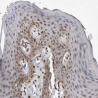 Immunohistochemical staining of human skin shows moderate granular cytoplasmic positivity in epidermal cells.