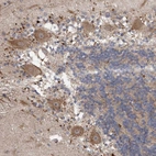 Immunohistochemical staining of human cerebellum shows moderate cytoplasmic positivity in purkinje cells.