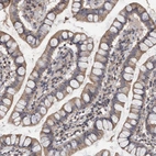 Immunohistochemical staining of human small intestine shows weak to moderate cytoplasmic positivity in glandular cells.
