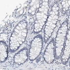 Immunohistochemical staining of human colon shows no positivity in glandular cells.