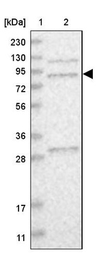 Lane 1: Marker [kDa] 230, 130, 95, 72, 56, 36, 28, 17, 11_br/_Lane 2: Human cell line RT-4