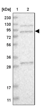 Lane 1: Marker [kDa] 230, 130, 95, 72, 56, 36, 28, 17, 11_br/_Lane 2: Human cell line RT-4