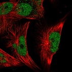 Immunofluorescent staining of human cell line U-251 MG shows localization to nucleoplasm.