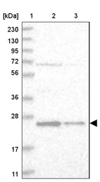 Lane 1: Marker [kDa] 230, 130, 95, 72, 56, 36, 28, 17, 11_br/_Lane 2: Human cell line RT-4_br/_Lane 3: Human cell line U-251MG sp