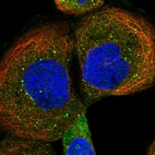 Immunofluorescent staining of human cell line A-431 shows localization to cytosol & vesicles.