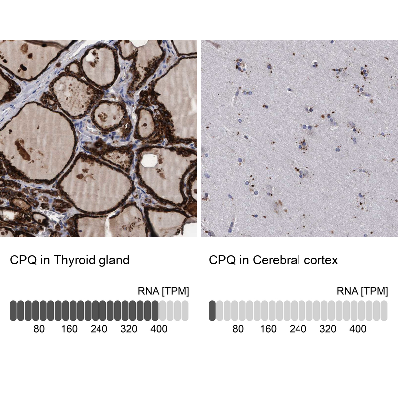 Anti-CPQ Antibody