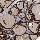 Immunohistochemical staining of human thyroid gland shows high expression.