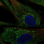 Immunofluorescent staining of human cell line ASC TERT1 shows localization to the Golgi apparatus & vesicles.