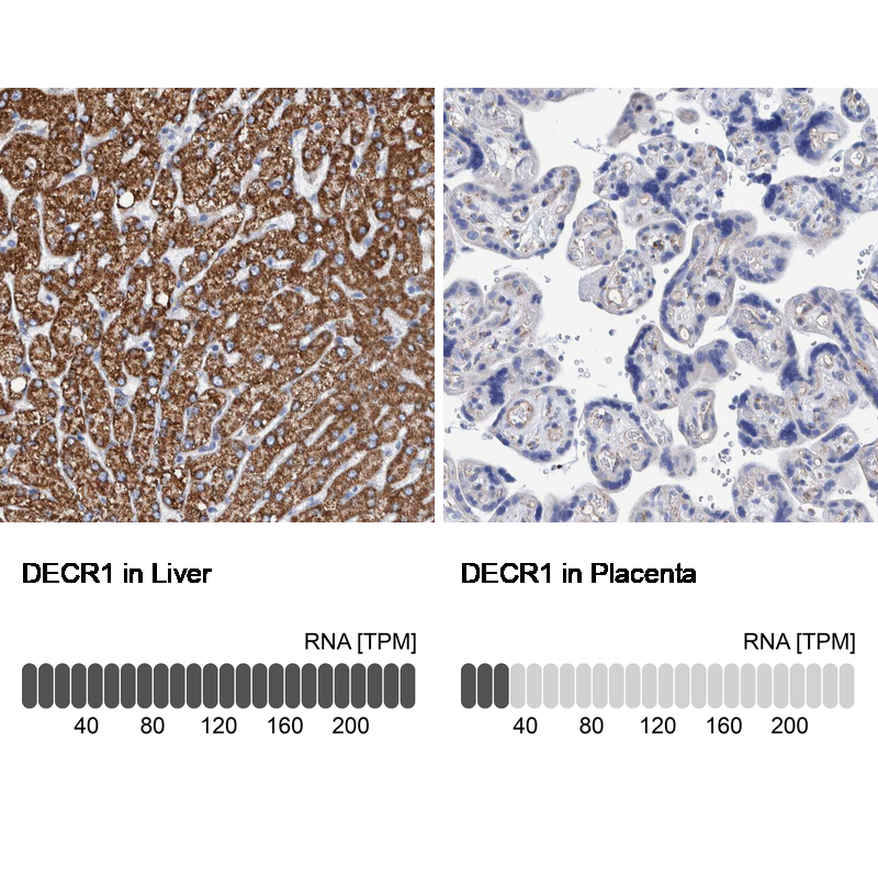 Anti-DECR1 Antibody